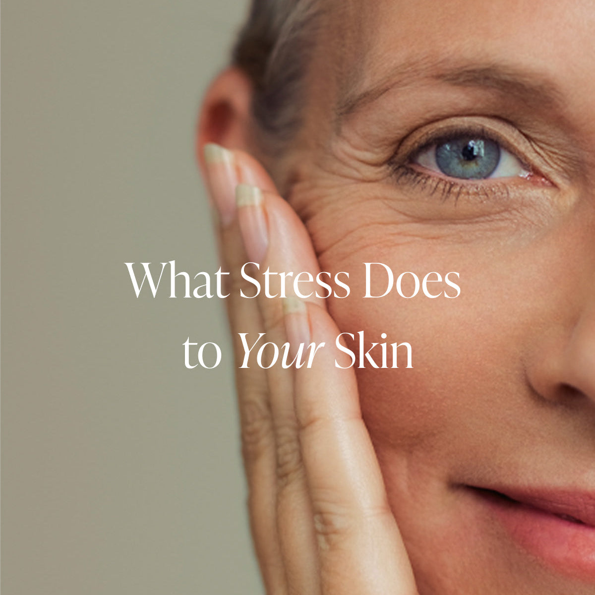 Close-up of woman's under-eye area — what stress does to your skin, Blumenès